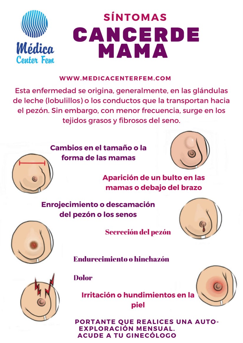 sintomas cancer-de-mama