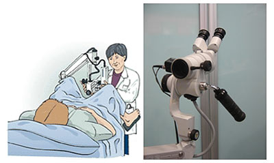 como se realiza una colposcopia