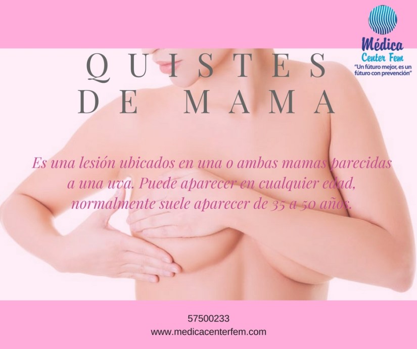 Quistes de mama