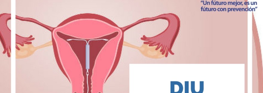 diu (dispositivo intrauterino)