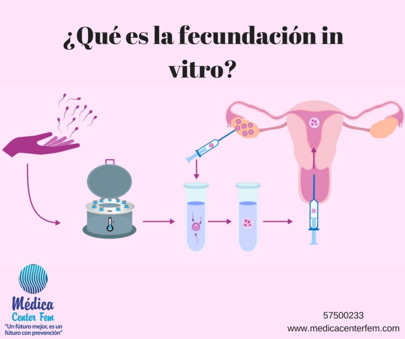 ¿Qué es la fecundación in vitro?