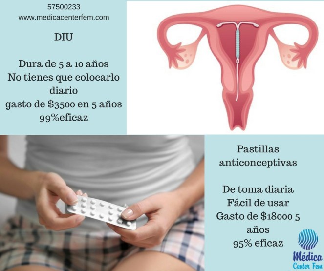 pastillas anticonceptivas vs diu