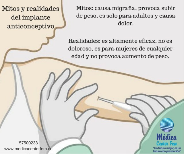 implante anticonceptivo