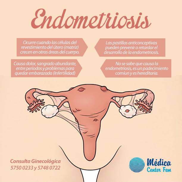 que es la Endometriosis