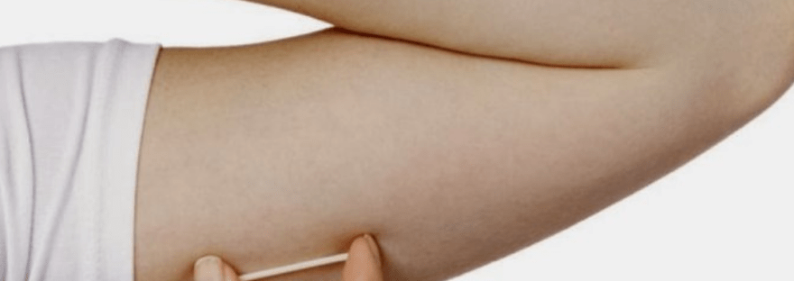 Beneficios del Implante subdermico