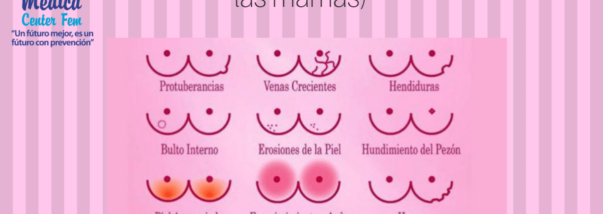 Cáncer de mama (secreciones de las mamas)