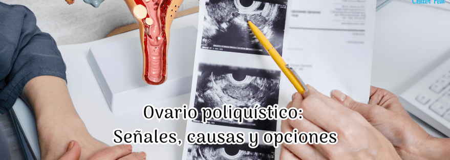 sindrome-de-ovario-poliquistico